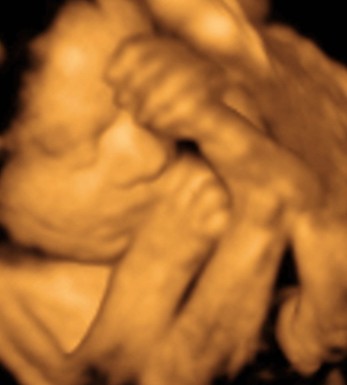 4D ULTRASOUND PICTURES 28 WEEKS image galleries - imageKB.com